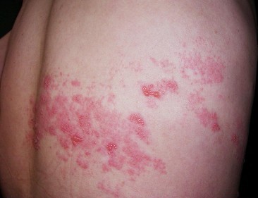 ��״�����Ԥ��,�ɶ�����ҽԺ