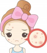 成都专业治青春痘医院